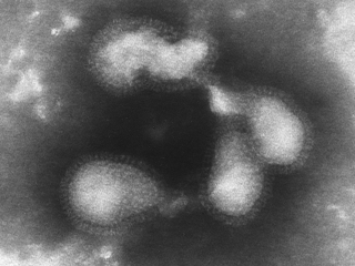 インフルエンザウイルス顕微鏡写真